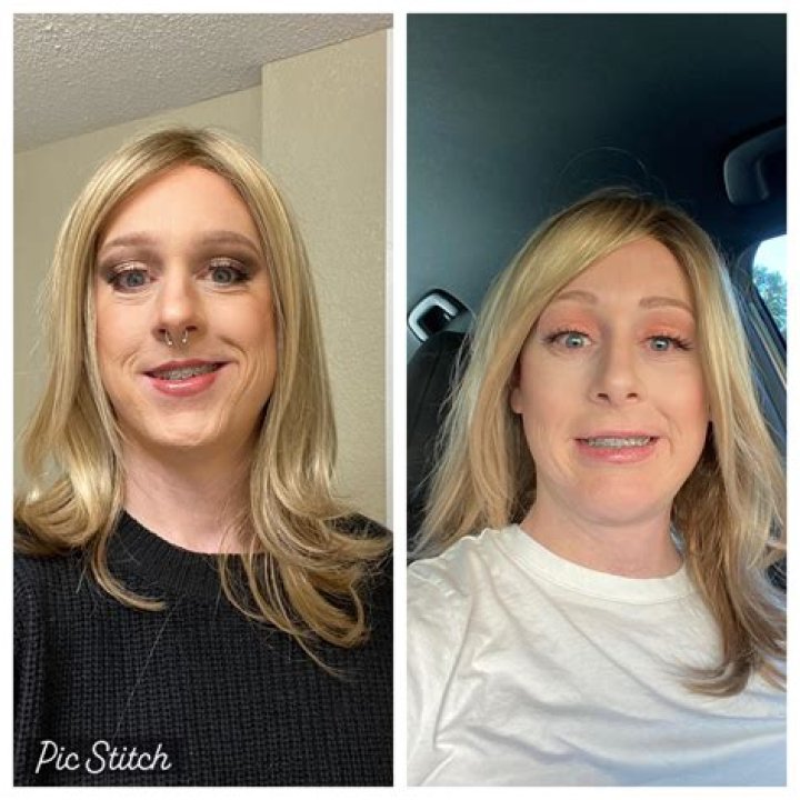 
Gemma Owen Plastic Surgery Trending On Tiktok: Before And After Photo 