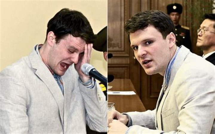
What Happened To Otto Warmbier Teeth? Surgery And Before After Photos 