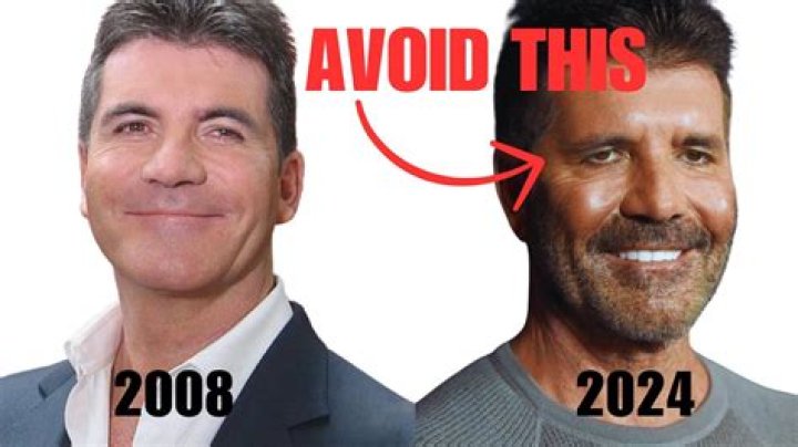 What Happened To Simon Cowell Face And Eye? Has He Had A Stroke Or An Accident?